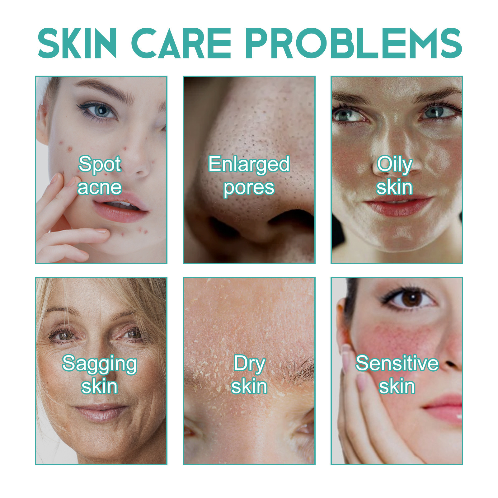 Jayswing Concentrated to Lighten Marks, Relieve Skin, Remove Acne, Control Oil, and Close Mouth Acne essence_voghion.com