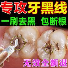 牙膏去黑线黑渍牙窝沟牙齿牙菌斑蛀牙虫洞牙缝发黑牙渍祛除神器YE