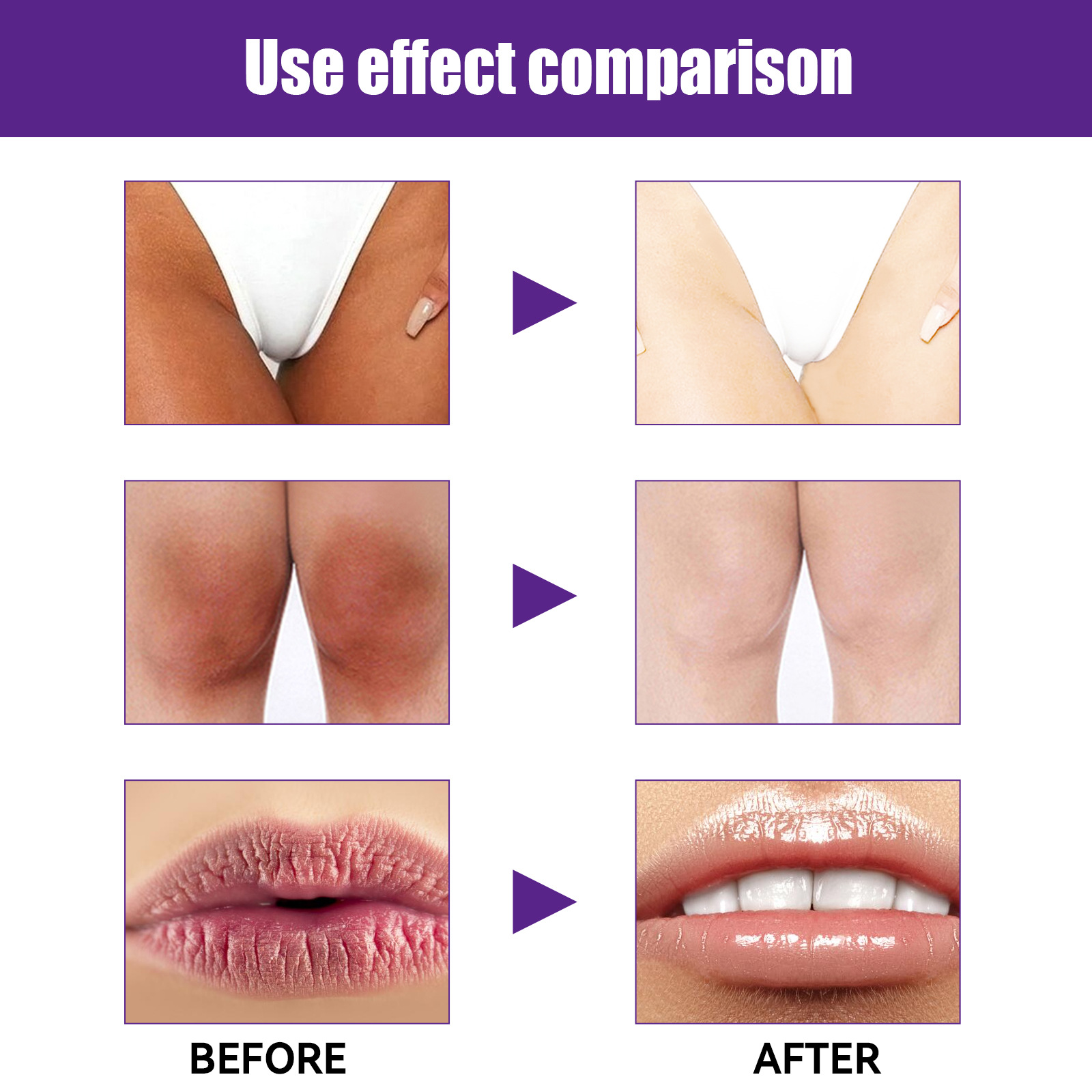 EELHOE Cremă hidratantă naturală pentru iluminare, fermitate a pielii, reduce buzele, axilele, articulațiile, melanina, cremă de albire a pielii_voghion.com