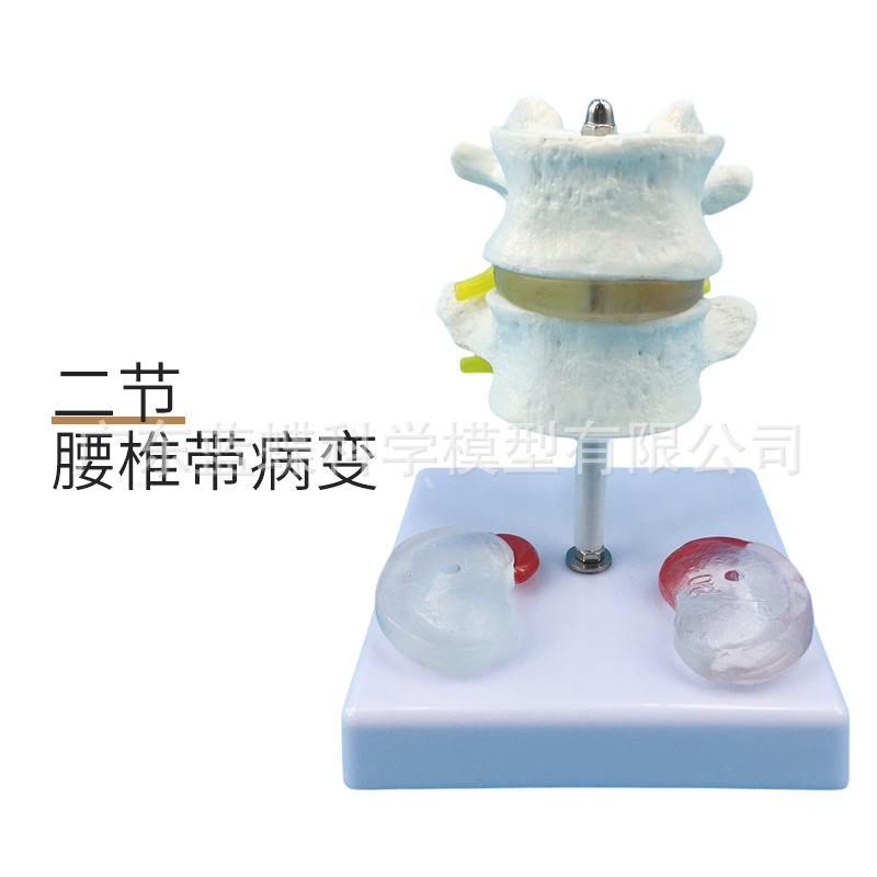 ���弹��ģ�ͼ�׵����׵ģ�� ��׵�ṹ��׵���� �ؽ�ģ�߲�����׵