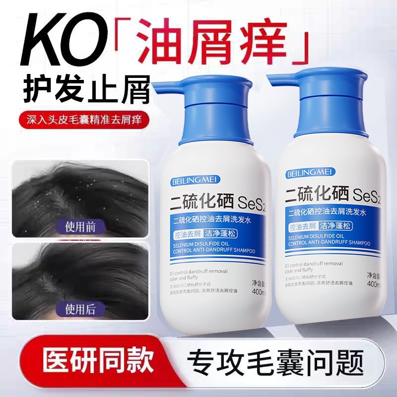 베링메이 이황화셀레늄 오일 컨트롤 비듬 제거 샴푸 모낭 클렌징 오일 컨트롤 볼륨 가려움 방지 샴푸 정품