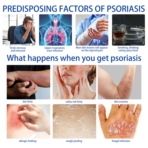 South Moon Skin Itching Lotion