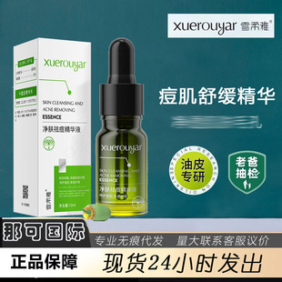 ��48С�r�Ȱl؛��ѩ����С�Gƿ����AҺ���м����A�;��AҺ