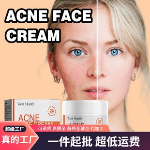 West&Month Salicylic Acid Facial Mask Gentle Cleansing Facial Mask Fading Acne Marks Firming Pores Purifying Facial Mask
