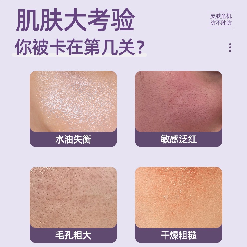 Suxiu Chen 's 20% crema de ácido azelanico, enrojecimiento, hidratación, suave y brillante, exclusiva transfronteriza.