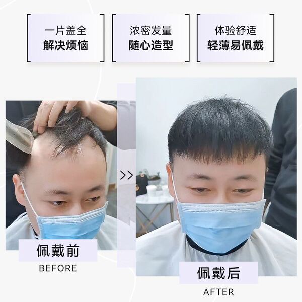 Men's wig along the hairline