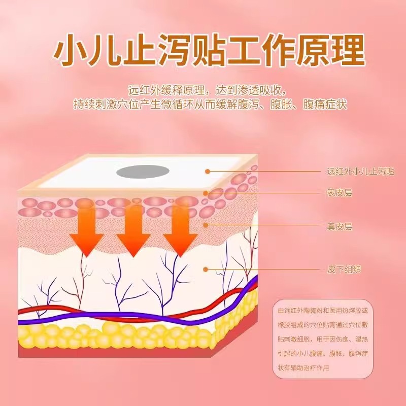 医用远红外小儿止泻贴肚脐贴腹泻胀痛辅助治疗现货械字号代加工|undefined