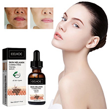 EELHOE �沿�������� ��ʪ�����������ʸ�ϸ������ճ��沿����