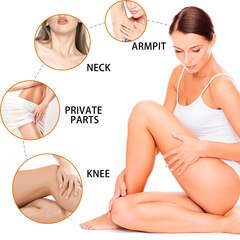 OUHOE 黑斑修復霜 淡化黑斑膝蓋手肘細嫩提亮膚色滋潤肌膚身體乳