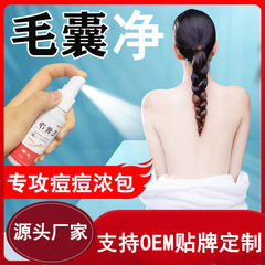 Furuncle Purifying Antiseptic Liquid, Scalp Itch Relief, Sebum-Controlling Furuncle Soothing Cleanser, Herbal Spray, Furuncle Repair Mist