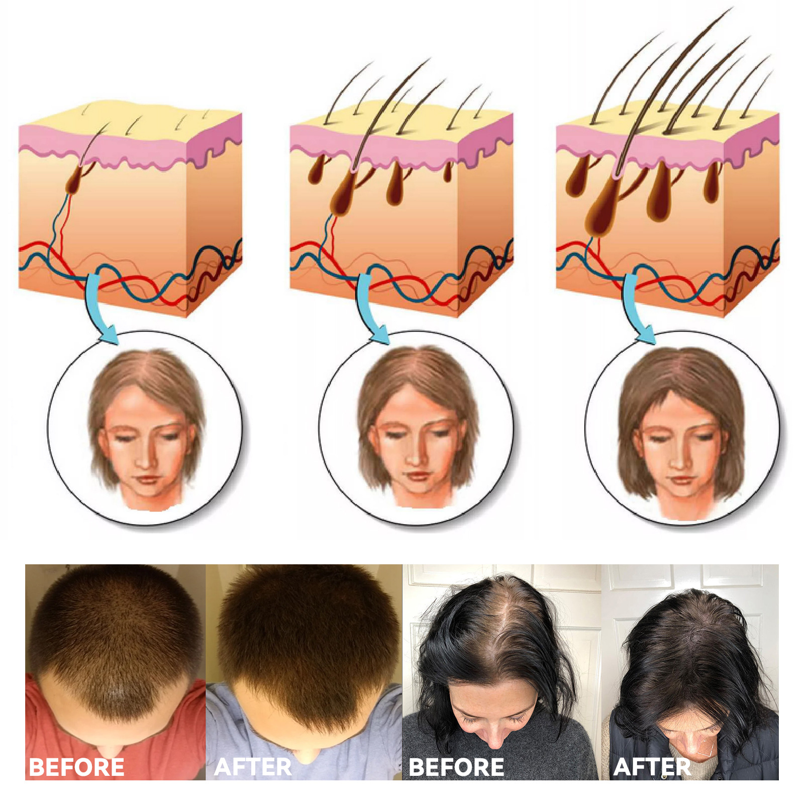 Ginger Hair EELHOE Care Po Hydrateert, voedt, versterkt en voorkomt breuk. Zwarte haarverzorging met gin_voghion.com