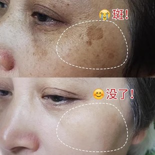 �ܹ�����˪ȥ��ɫ�ص���ɫ���S�ְ������ȸ�����۰׿�ɫ˪���˪