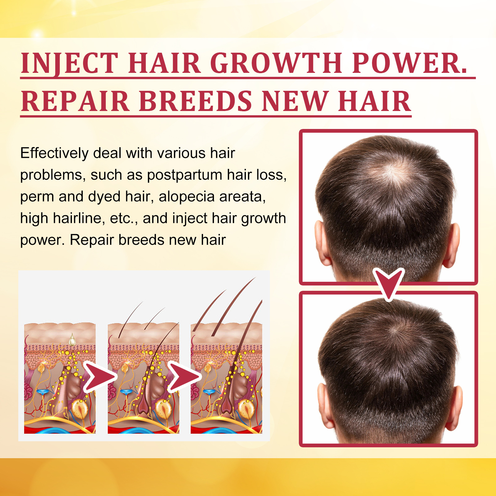 EELHOE Hoerwuesstemsserum reparéiert Hoerfollikelen, verdickt a wiisst staark, masséiert a reparéiert Hoerwuerzelen, befeucht a stäerkt d'Hoer._voghion.com