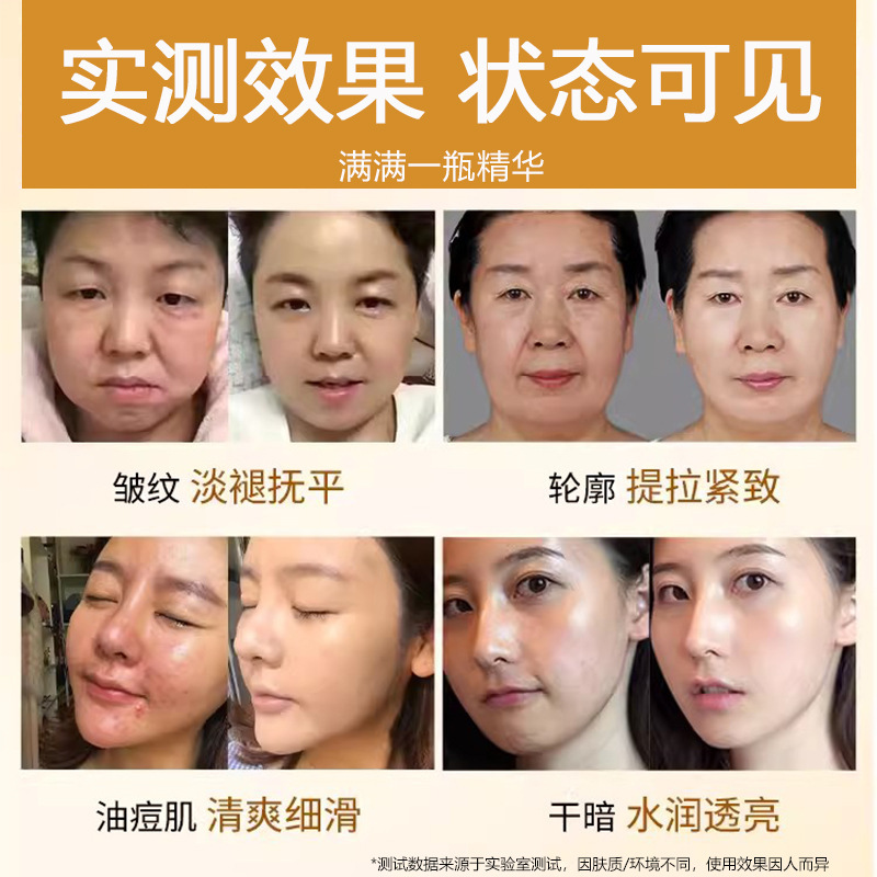 高濃度羊プラセンタエッセンス、小じわを軽減、引き締め、明るくし、潤いを与えるフラーレンプラセンタ抗シワエッセンス|undefined