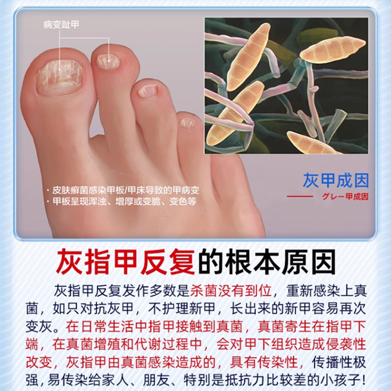 岩井弘灰爪亮甲脱甲増厚発黄専用鳳仙花抗菌液氷酢酸工場直営|undefined