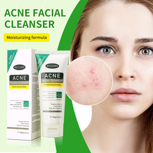 �羳���QMEJISOO ACNE FACIAL CLEANSER �ϴ����100g�S�����l