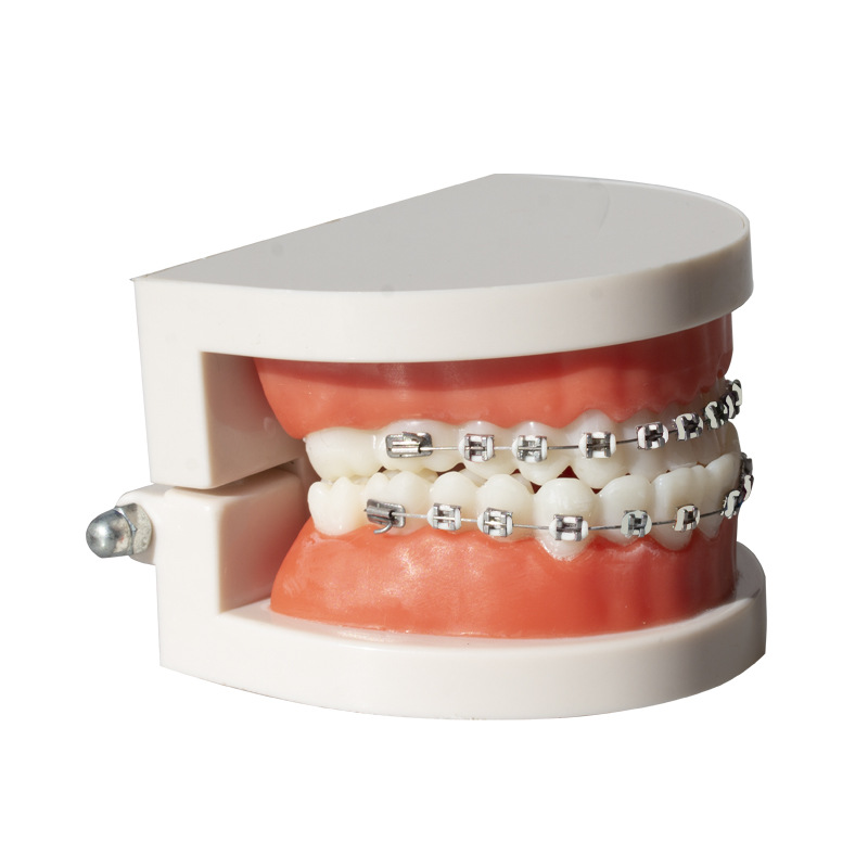 Modelo de corrección dental ortodoncia dental molde de metal de cerámica soporte de contraste arco modelo de visualización de alambre