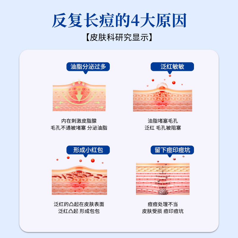 香港大药房痘痘净草本祛痘膏控油去痘印去粉刺温和净颜植物祛痘膏|undefined