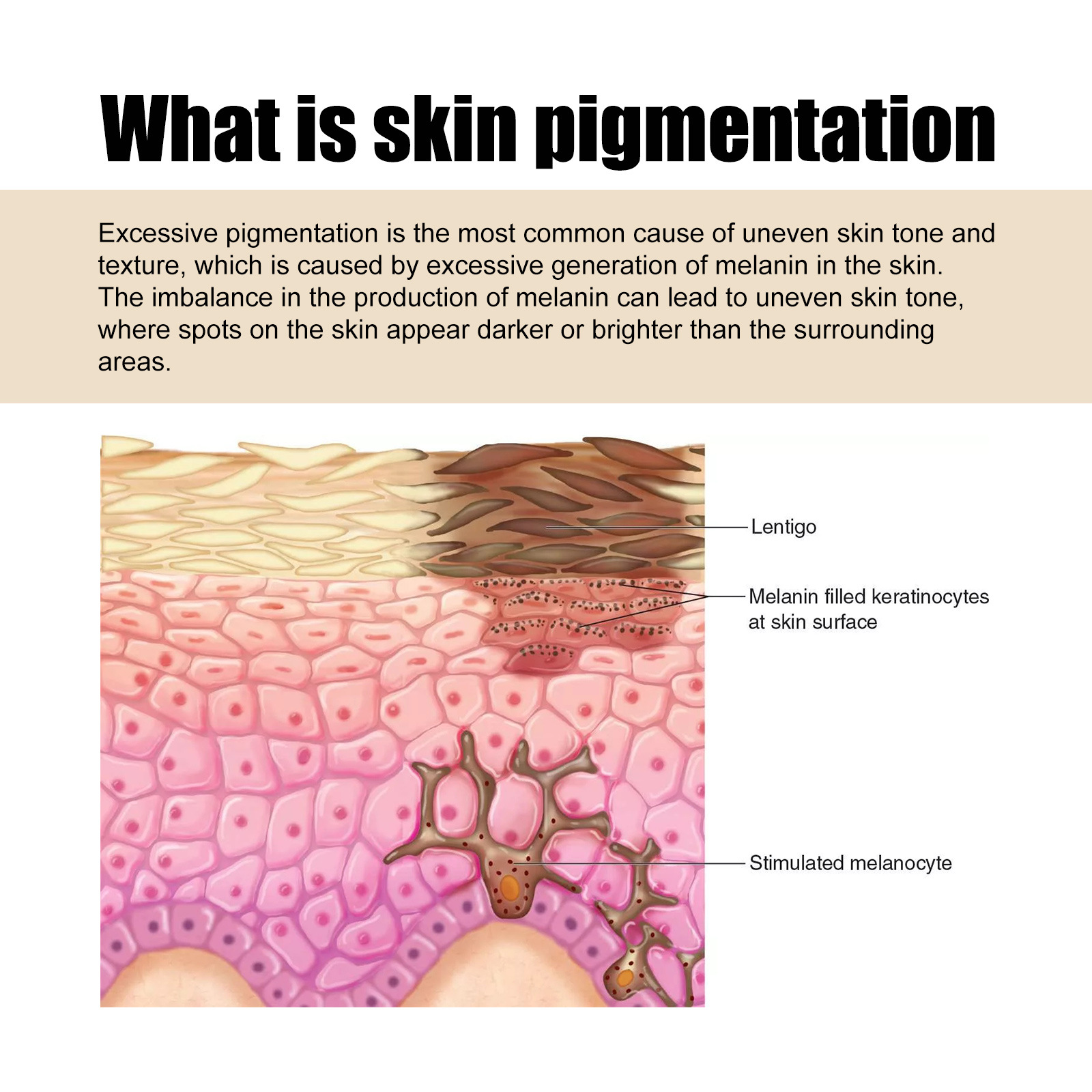 West&Month Leke Düzeltme Kremi Dirsek Koltuk Altı Eklemi Onarımı Siyah Beyazlatıcı, Nemlendirici ve_voghion.com