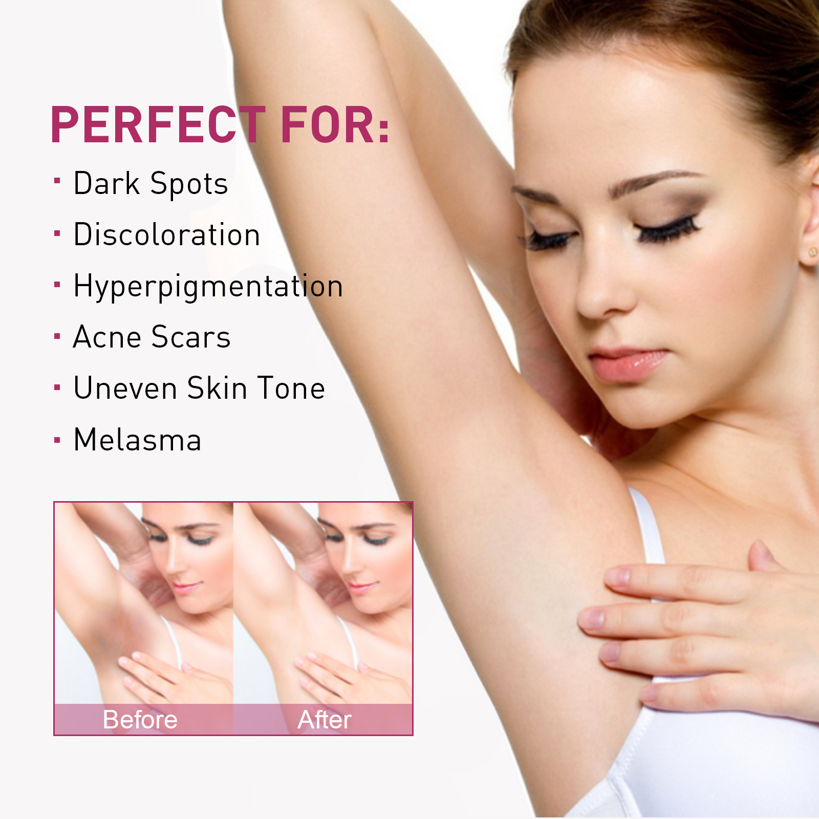 EELHOE Underarm Whitening Cream Repairs armpit joints and dilutes melanin Moisturizing and rejuvenating skin whitening cream_voghion.com