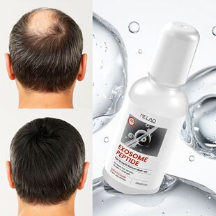 �羳�����^�l���A�L���^Ƥ�I�BҺ�l�����ܾ���Exosome Peptide