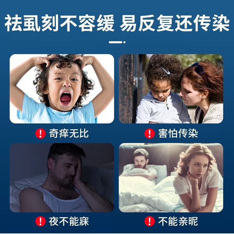 수정 된 화합물 백 버스 팅크 액체 이가 약 어린 소녀 머리카락 이가 수직 그물 제거 이가 계란 근절 머리 이가 음모
