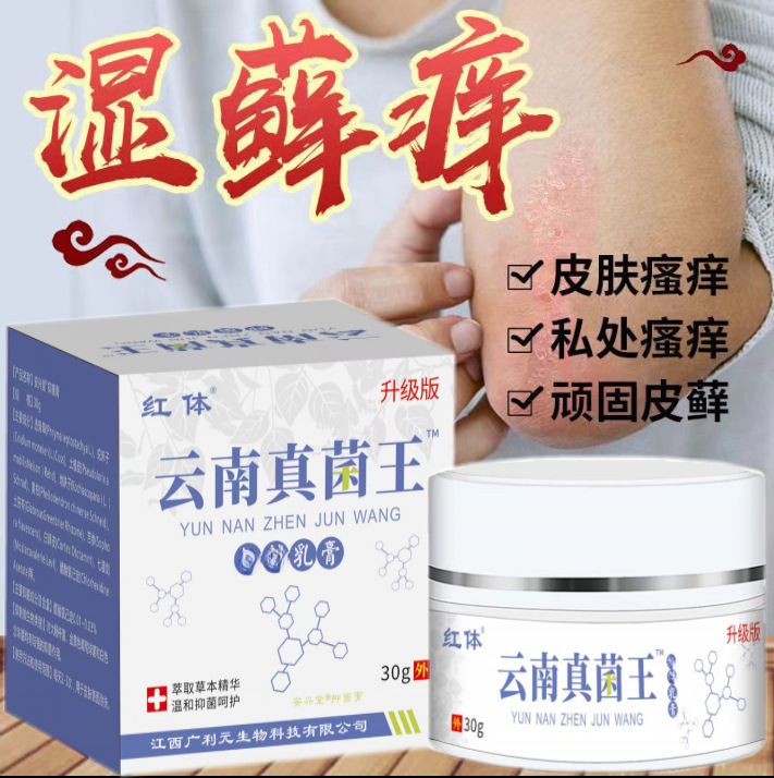 雲南真菌王工場皮膚かゆみ止めクリーム掻痒蚊虫刺され震え音速手生中継代理|undefined