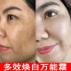 All-purpose Cream, All-purpose Milk, Anti-acne Cream, Whitening, Spot Removal Cream, Firming, Anti-wrinkle, Moisturizing, Skin Care, Color Control, Multi-effect Cream