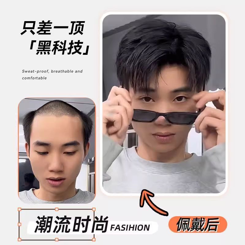 【立体微分碎盖】假发男头顶真发自然帅气脱发隐形补发片男士假发|undefined