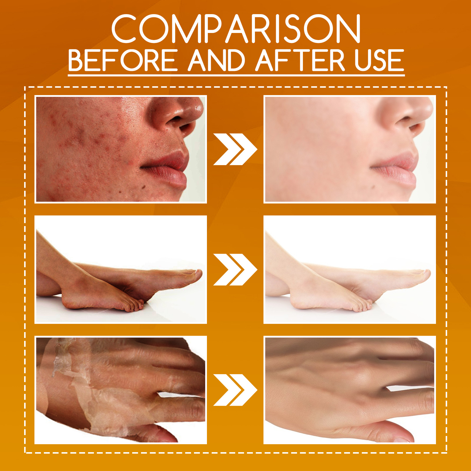 OUHOE Orange Skin Körperlotion mildes Peeling, verblasst dunkle Flecken, hellt die Haut auf, befeuchtet die Hautpflegeflüssigkeit_voghion.com