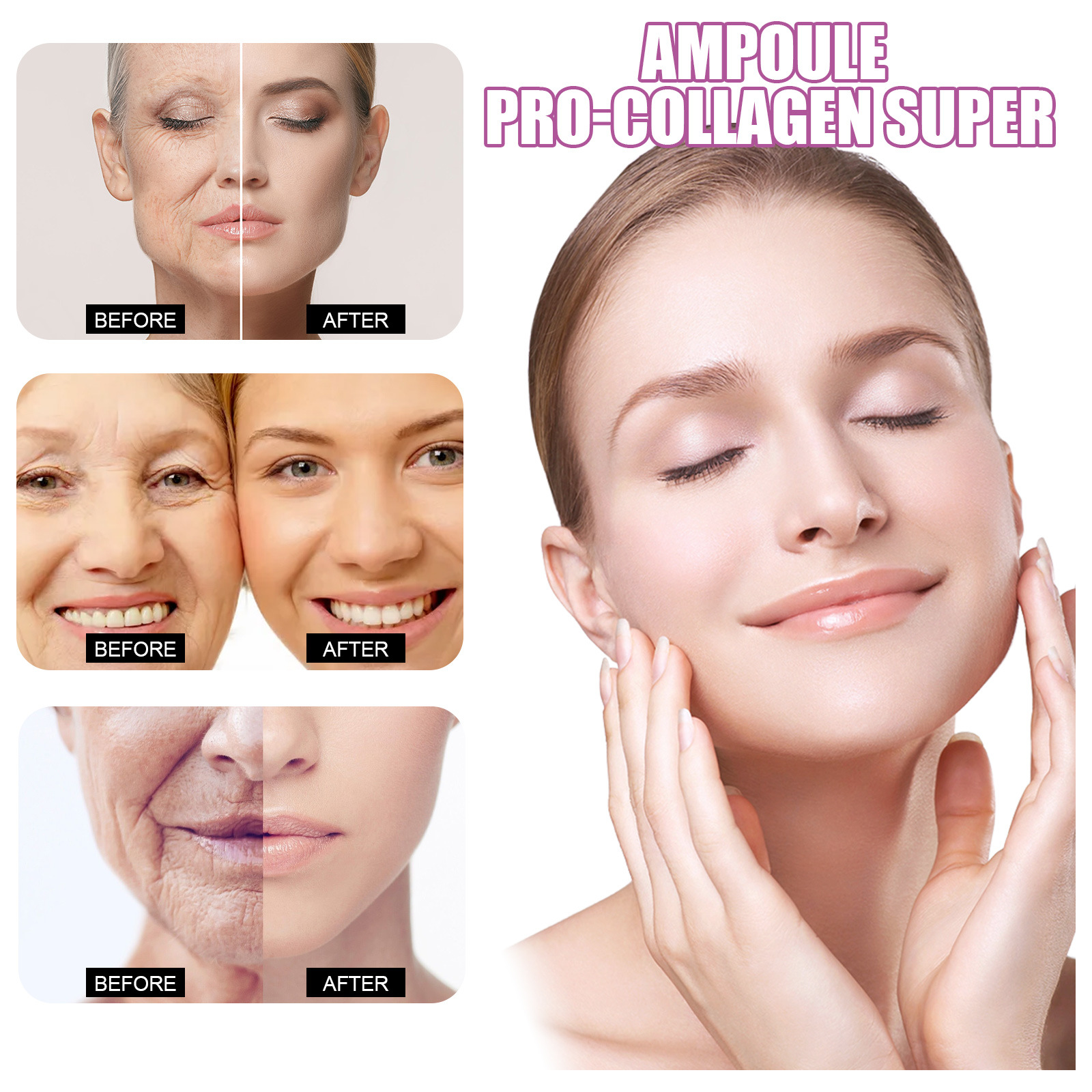 L'essenza pre-fiala di ceramide EELHOE indebolisce le linee sottili, ricostituisce l'acqua e il collagene può migliorare l'antirughe della pelle_voghion.com