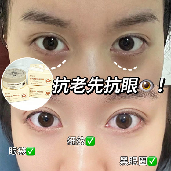 Su Xiu Sen's Carnosine Tightening Huan Jing Eye Mold Fades Eye Circles Eye Bags Littering Tightening Moisturizing Moisturizing Shake Tone Same