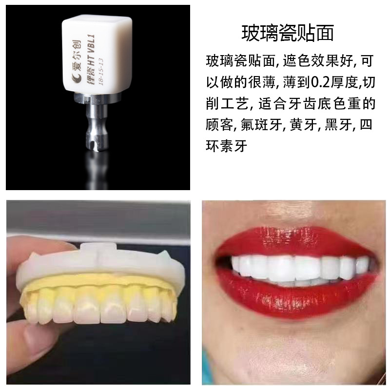 Tiras blanqueadoras de dientes, dientes de porcelana privados, porcelana azul, porcelana ámbar, enseñanza y formación para estudiantes, carillas totalmente cerámicas