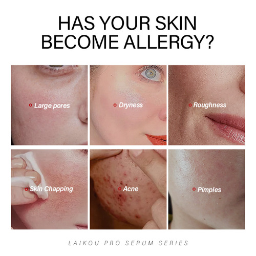 LAIKOU LEIKOU PRO 4-color Essence Liquid 12ml Moisturizing and Hydrating Skin Care Products Cross-border Sources of English Packaging 