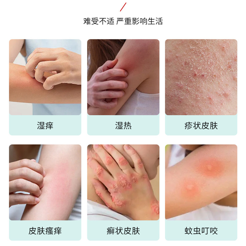 香港李四郎湿毒清痒膏 舒缓皮肤不适皮肤瘙痒蚊虫叮咬外用保健膏|undefined