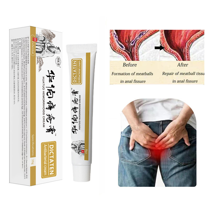 沈医堂痔疾膏、痔疾栓、痔疾ジェル、痔疾軟膏は越境で人気です。|undefined