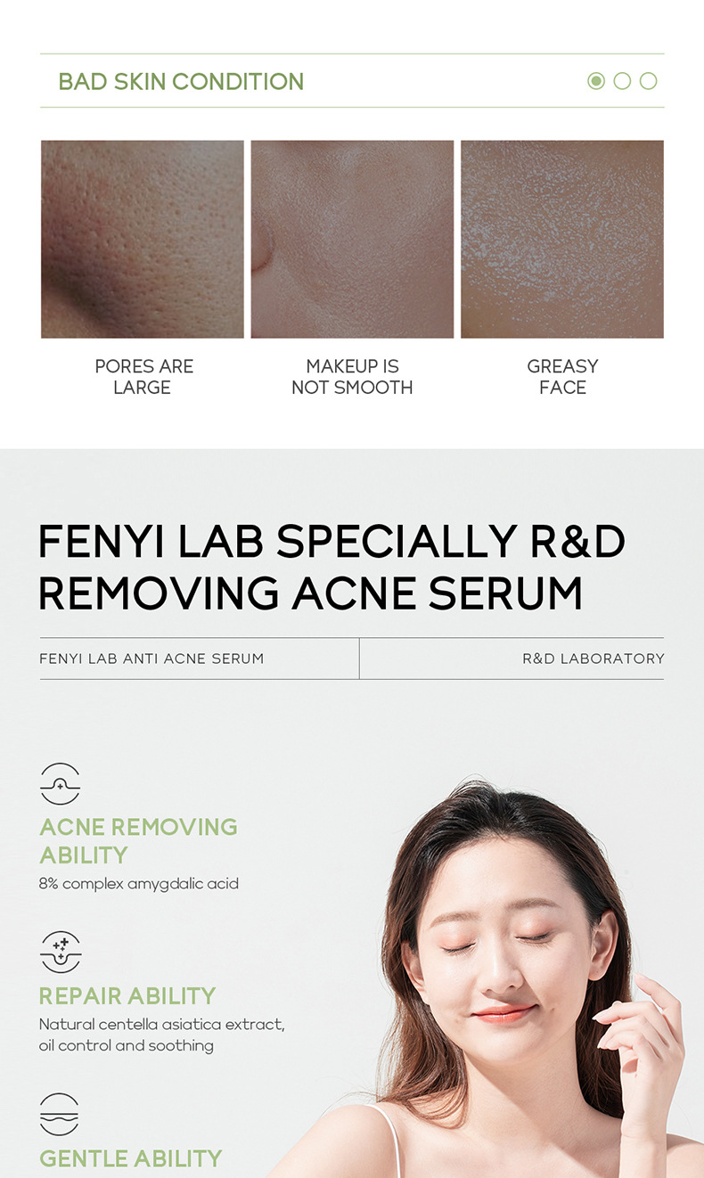 FENYI LAB Fenitol Acid Essence 17ml Facial Care Moisturizing and Hydrating Cross-border Skin Care Product undefined