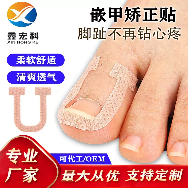 U形正甲贴脚趾嵌甲贴厂家免胶水甲沟修复专用贴片套装指甲纠正贴
