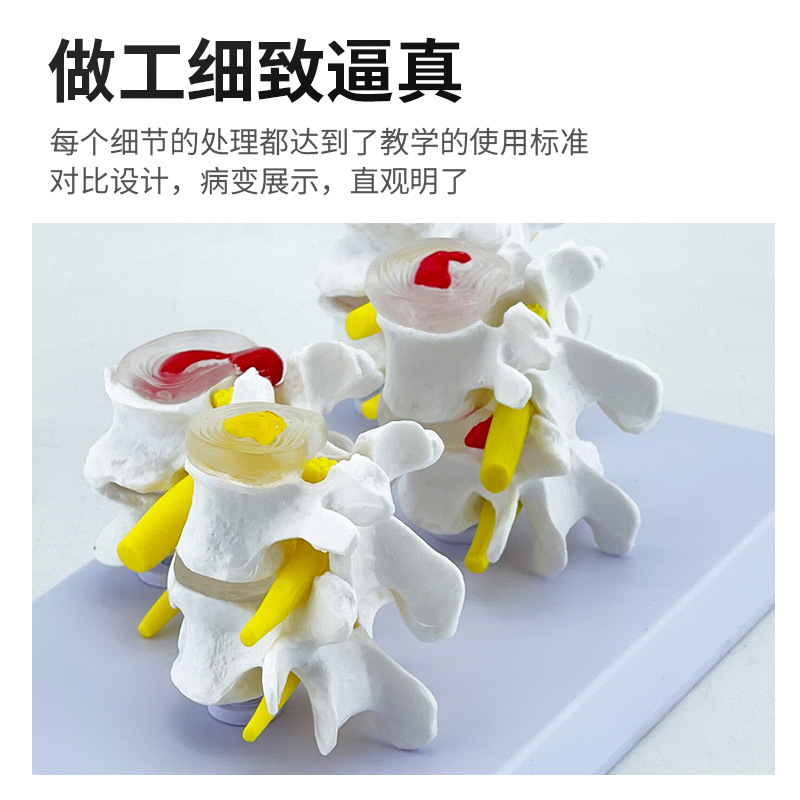 �ķ��ͼ�׵�����벡����׵���ģ�� ׵���̲�����׵��ʾ���� ����