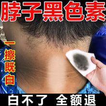 �۲������P��ȥ���ָ첲��ϥ�w�_�׸첲����Ҹ�µ�����ɫ��ȥ��Ƥ