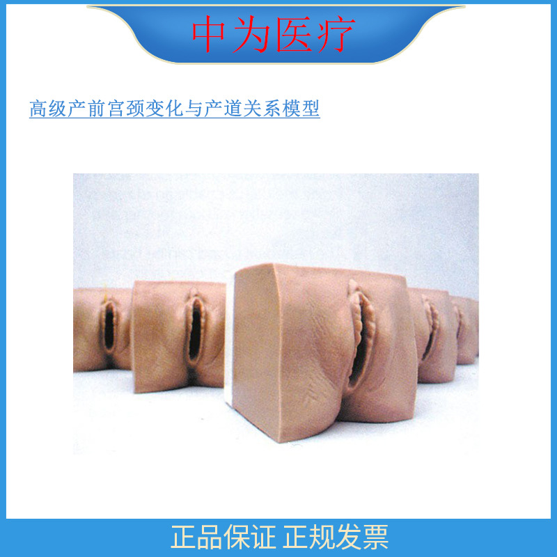 Model of relationship between advanced prenatal cervical changes and birth canal for medical 9A