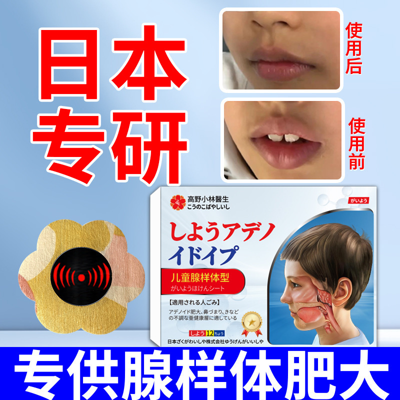 小児アデノイドパッチ、開口睡眠、開口呼吸ケア、鎮静ヘルスケアパッチ、小児アデノイド肥大軟膏パッチ|undefined