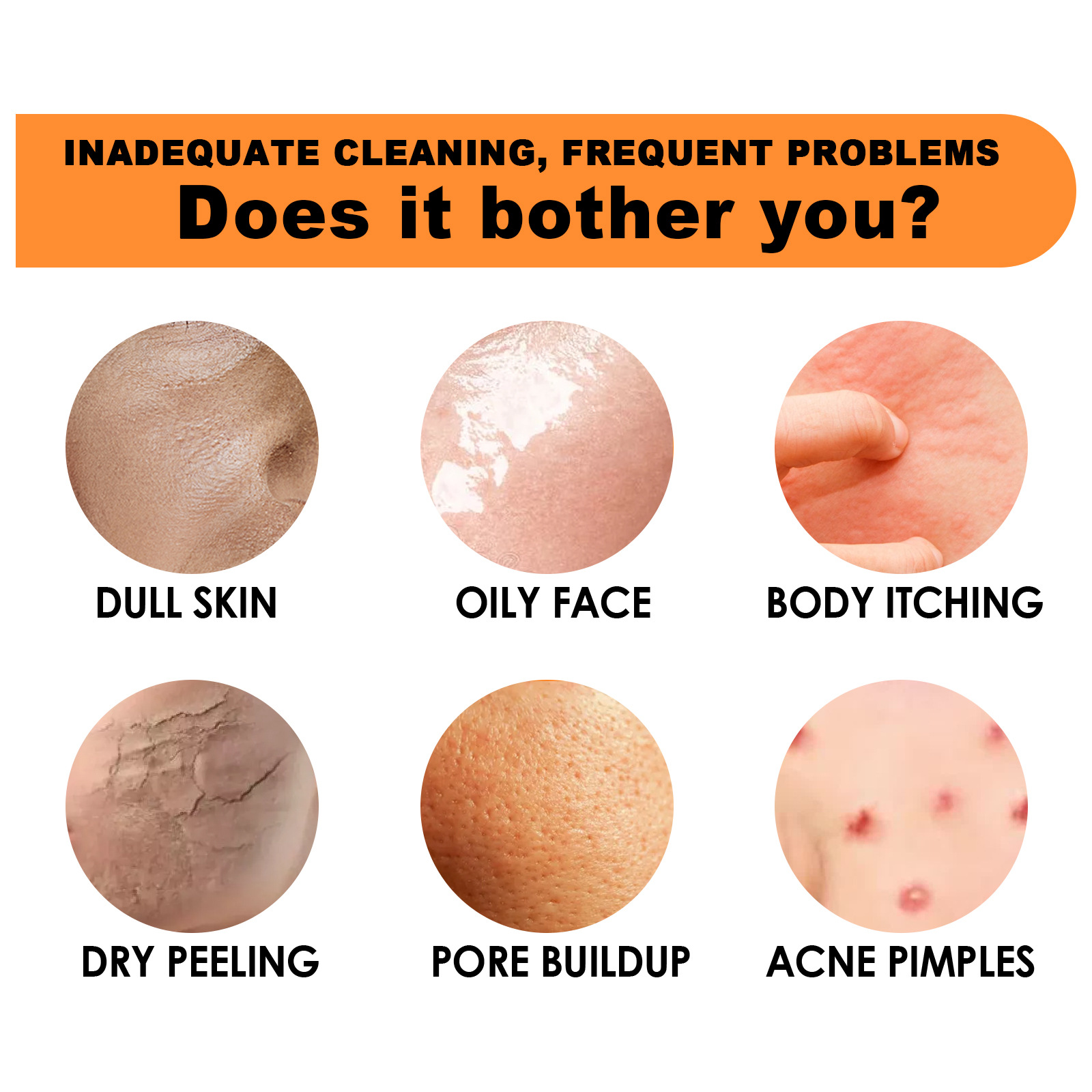 Jaysuing VC-Hautpflegeseife zur Befeuchtung des Körpers, zur Reinigung, zur Aufhellung und Aufhellung des Melanins der Gelenk-Ellenbogen-Haut_voghion.com