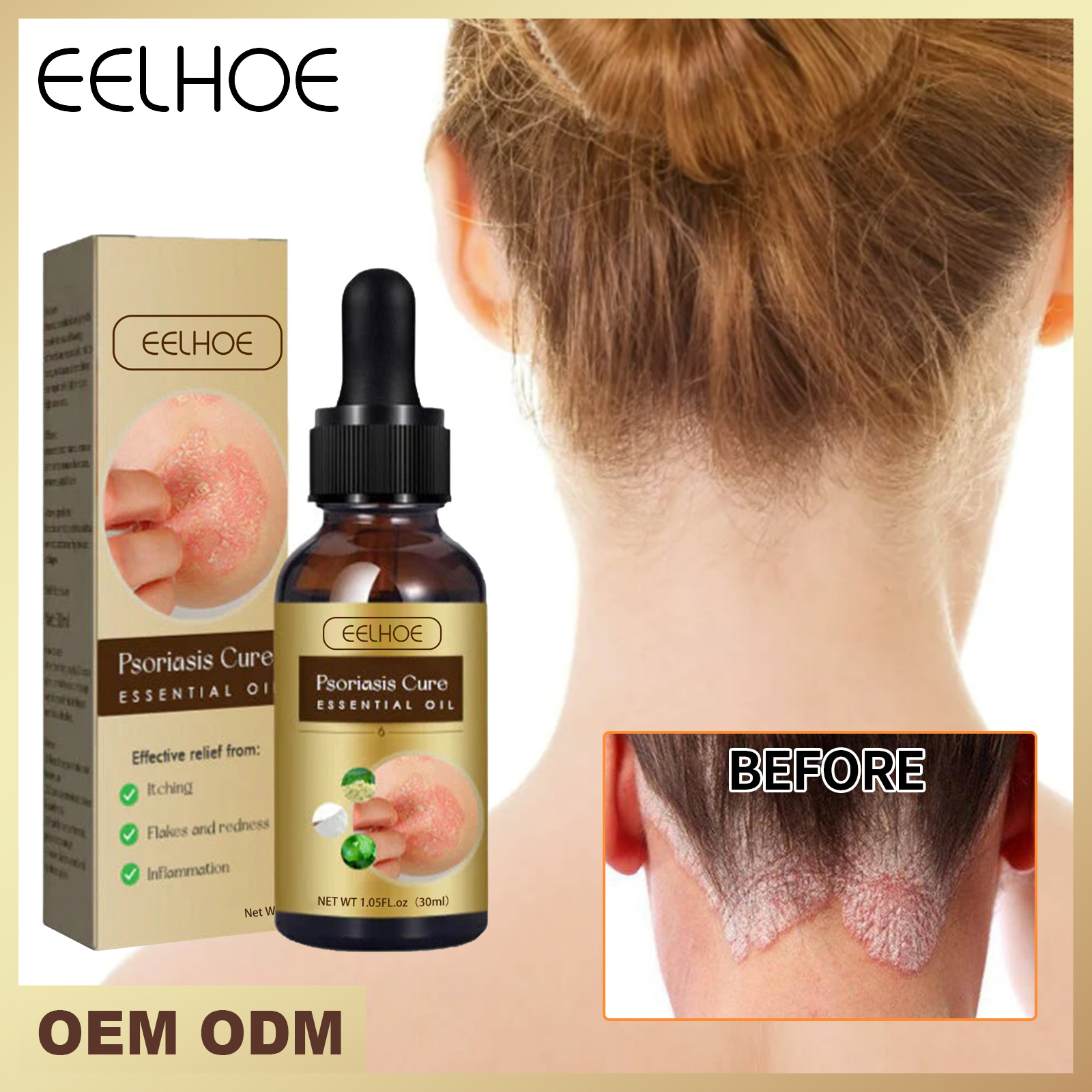 Skin Moss Beautiful Repair Essential Relieve Skin Itch, Stop Itch, Swelling, Hand and Foot Moss External Care Essentia_voghion.com