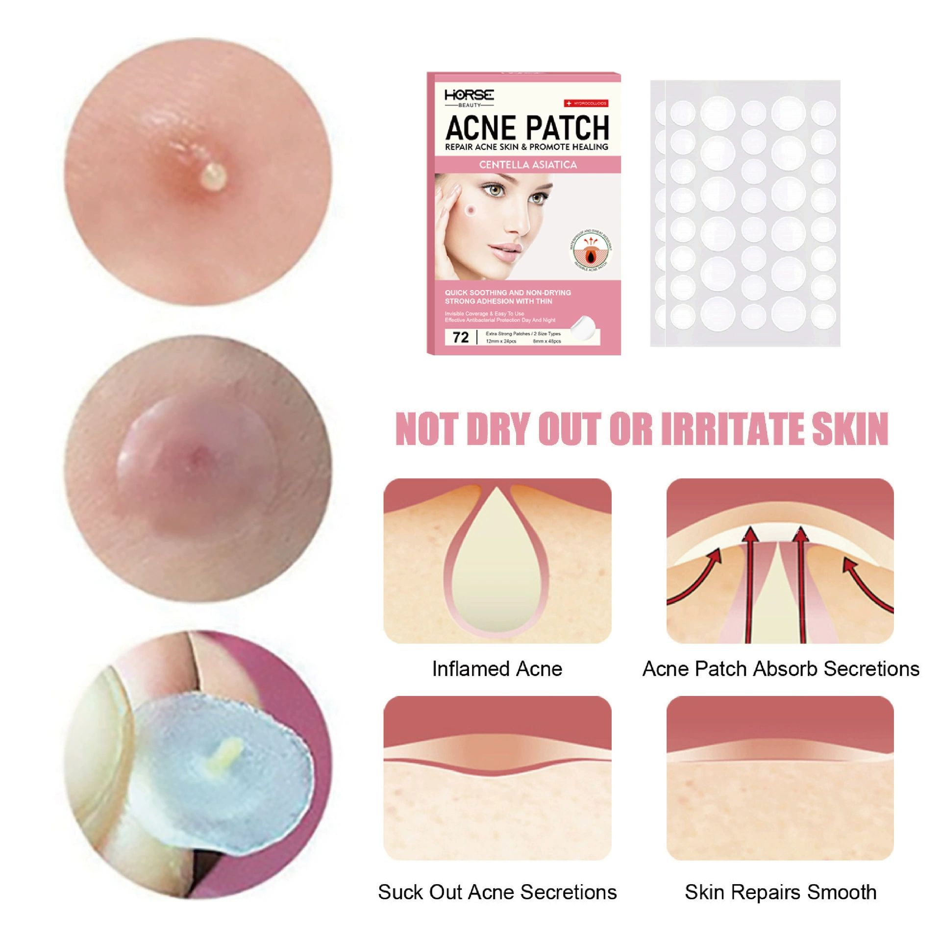 (Cross-border trading), invisible revitalizing acne patch, foundation, conceals acne