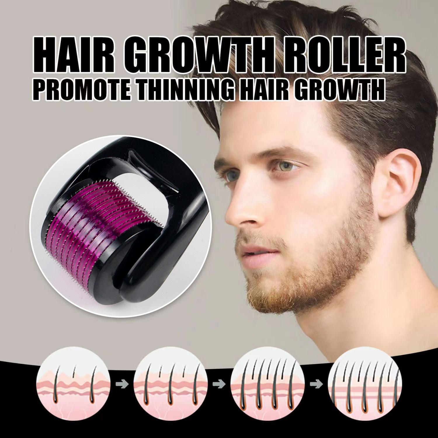 Microagullas de mosquitos para absorber el líquido superior de la cabeza para el crecimiento del cabello y la introducción de artefactos mágicos en el mesoderm