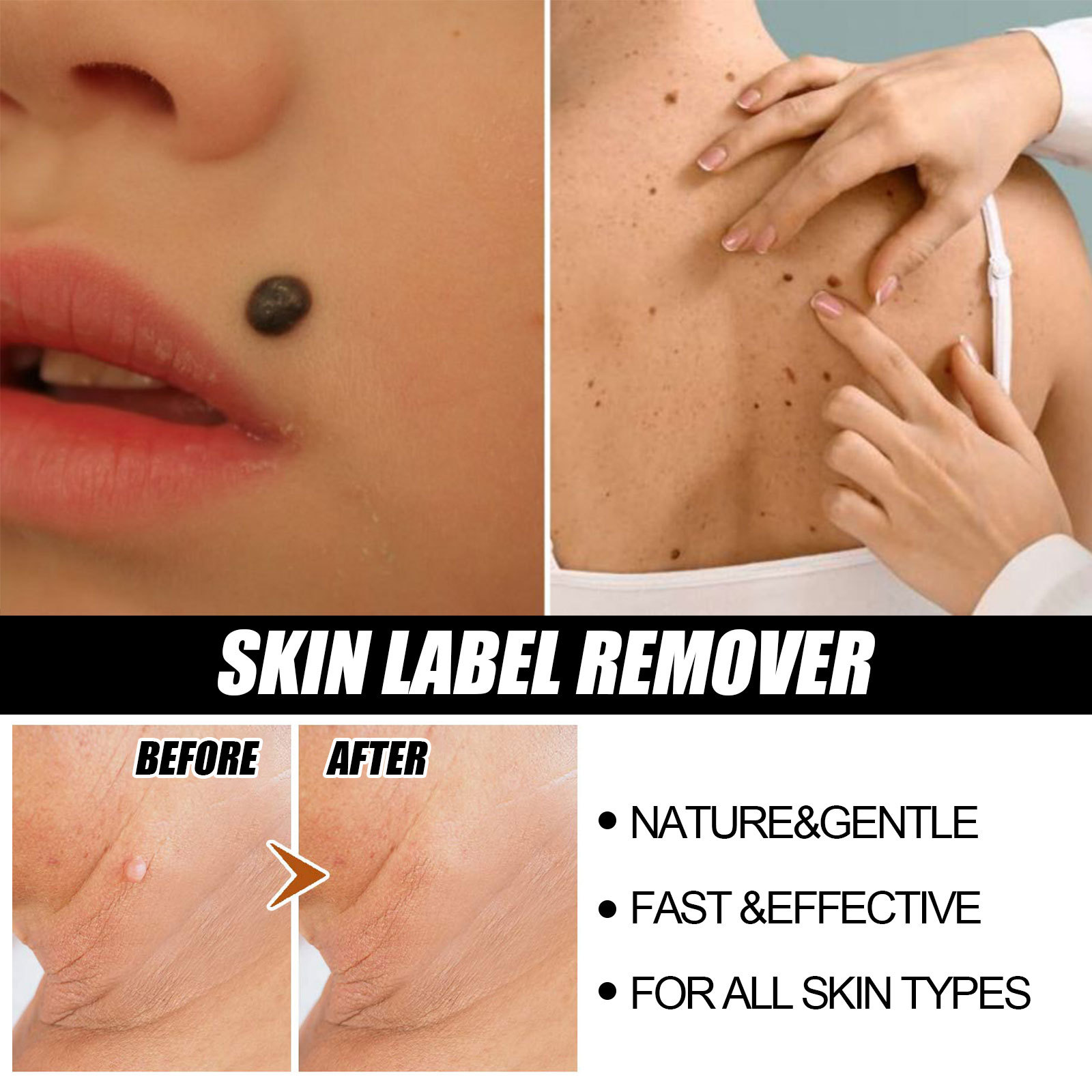 EELHOE repairing spots essence for skin flattening, wart removing and nevus eliminating solution_voghion.com