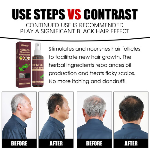 South Moon Herbal Black Hair Essence Polygonum multiflorum herbal essence moisturizes and cares for natural black hair, smooth and shiny