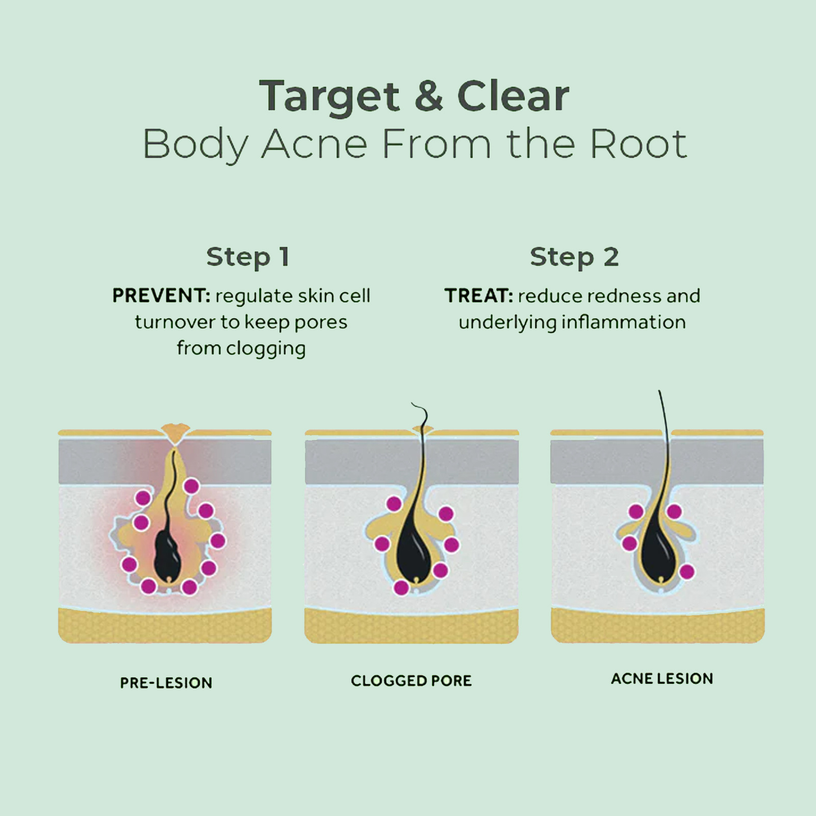 EELHOE repair reduces acne marks, cleans back, smoothes skin, and moisturizes spray_voghion.com