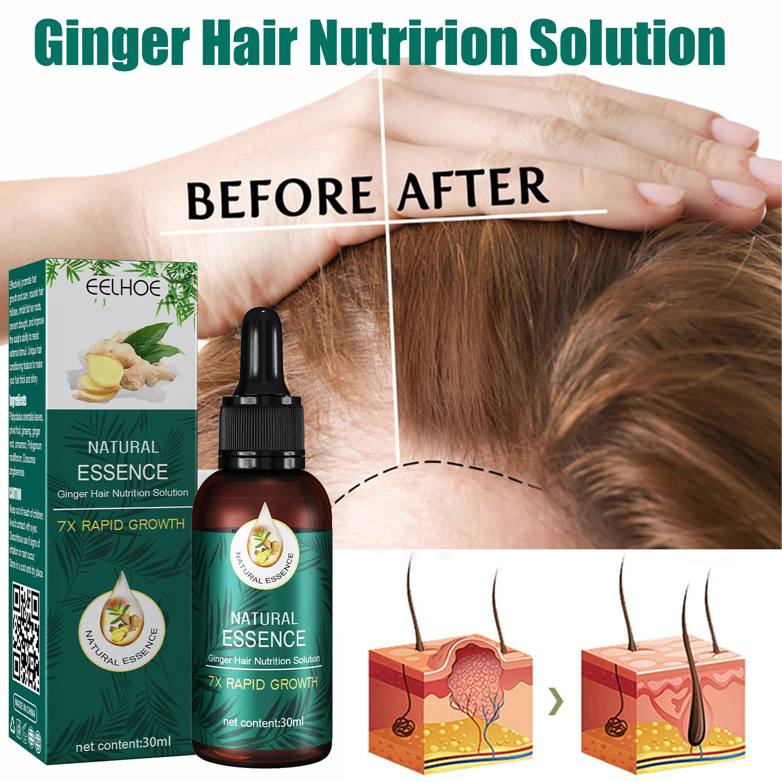 Care EELHOE Ginger Repairs Hair Follicles Grows Hair, Smoothing Soothing Dry and Fury Nutritional Essence Oil ,_voghion.com